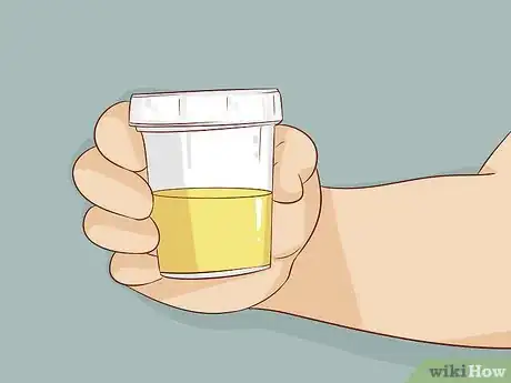 Image titled Become a Urologist Step 15