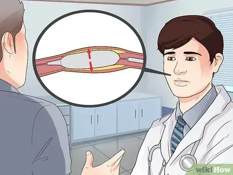 Image titled Spot Symptoms of Coronary Heart Disease Step 22