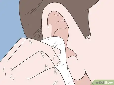Image titled Prevent Cerumen Impaction Step 1