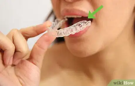 Image titled Whiten Your Teeth Without Spending a Lot of Money Step 1