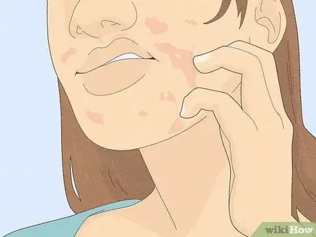 Image titled Wear Makeup when You Have Eczema Step 16