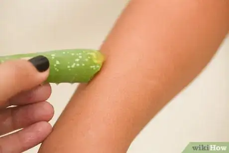 Image titled Prevent Chafing Step 15