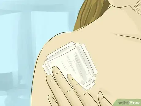 Image titled Treat Tumors Step 8