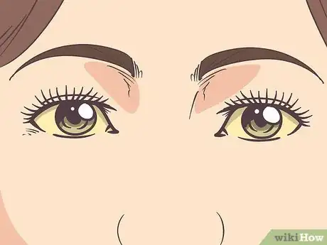 Image titled Recognize Signs and Symptoms of Ebola Step 7