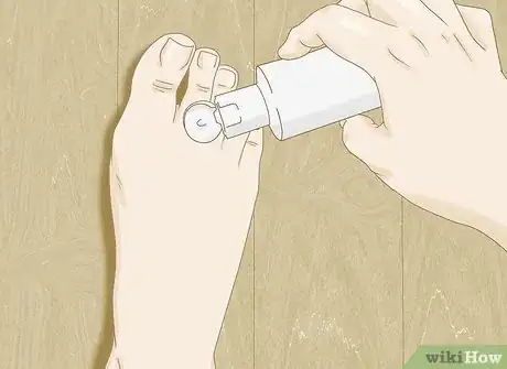 Image titled Make a Natural Foot Odor Remedy Step 4