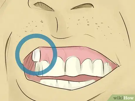 Image titled Treat Low Testosterone Step 3