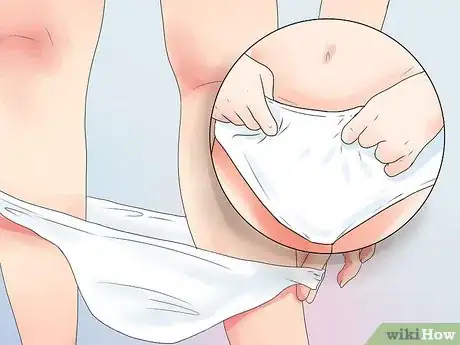 Image titled Prevent UTI During Pregnancy Step 6