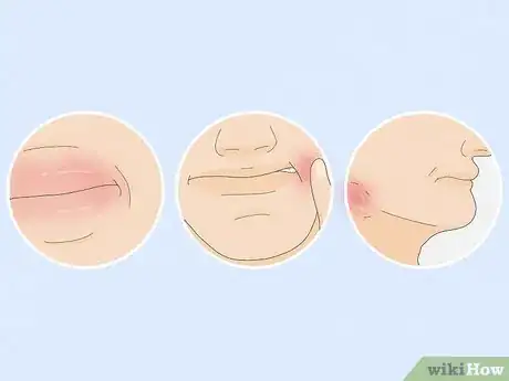 Image titled Manage Dental Health with Rheumatoid Arthritis Step 16