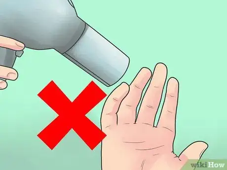 Image titled Heal Skin Damage from Frostbite Step 7