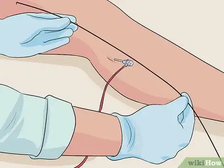 Image titled Get Rid of Varicose Veins Step 12