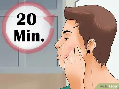 Image titled Use Lemon Juice in Your Beauty Routine Step 2