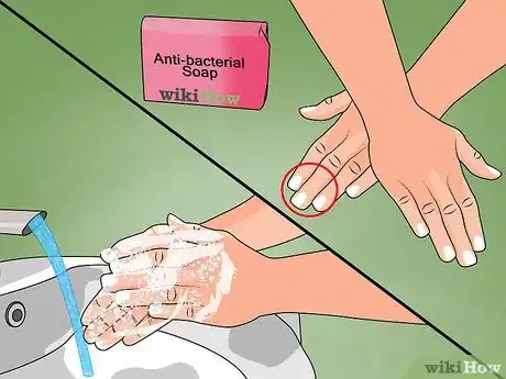 Image titled Care for a New Navel Piercing Step 2