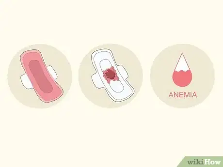 Image titled Treat Menorrhagia Step 13