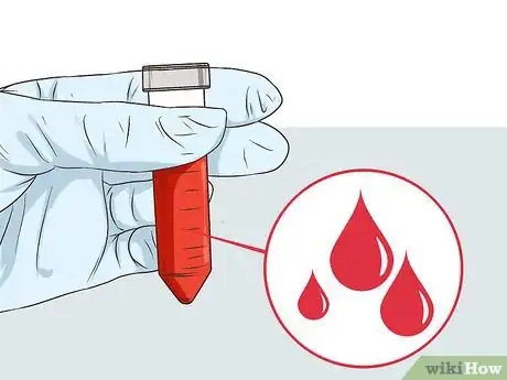 Image titled Diagnose the Cause of Dry Skin Step 11