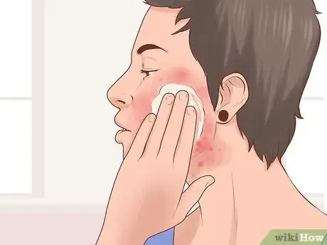 Image titled Prevent Swimmer's Ear (Otitis Externa) Step 7