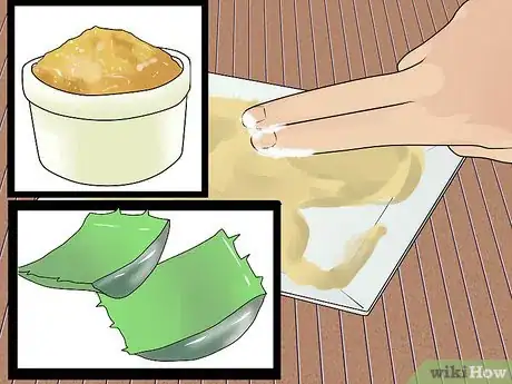 Image titled Treat Vaginal Cysts Step 9