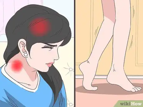 Image titled Recognize Signs and Symptoms of Ebola Step 9