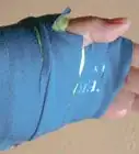 Make a Fake Arm Cast