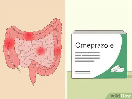 Image titled Treat Vitamin B12 Deficiency Step 3