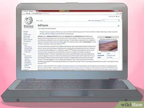 Image titled Stop Cutters Step 3