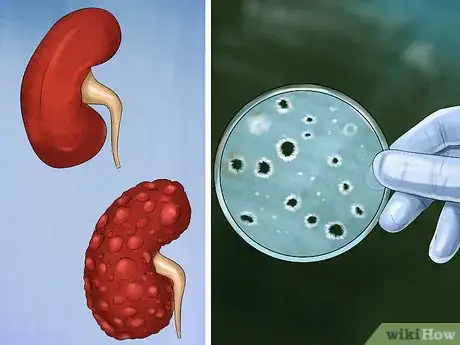 Image titled Check Your Cat's Nose Step 4