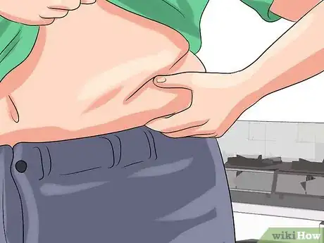 Image titled Treat Post Traumatic Arthritis Step 1