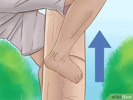 Image titled Climb a Tree With No Branches Step 6