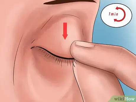 Image titled Administer Eye Drops in Children Step 15