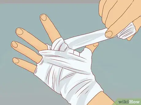 Image titled Prevent Common Krav Maga Injuries Step 8