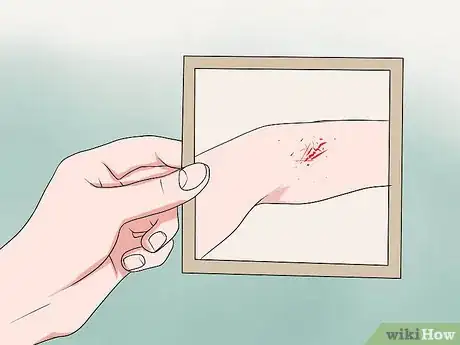 Image titled Win a Domestic Violence Case Step 9