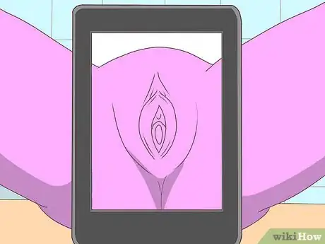 Image titled Prepare for a Vaginoplasty Step 8