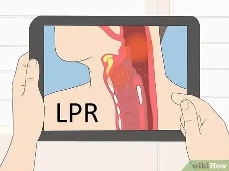 Image titled Diagnose Laryngopharyngeal Reflux Step 16