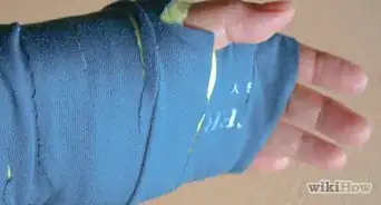 Make a Fake Arm Cast