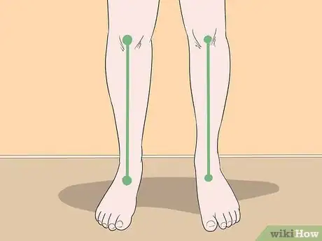 Image titled Avoid Patellar Tendonitis Step 3