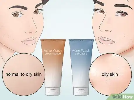 Image titled Wash an Acne Prone Face Step 2