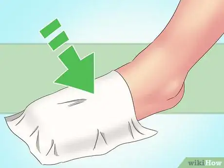 Image titled Make Felt Slippers Step 12