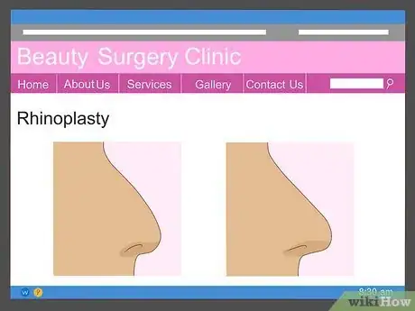 Image titled Have Plastic Surgery Step 14