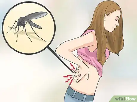 Image titled Ease Muscle Pain from Chikungunya Step 1