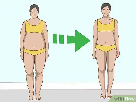 Image titled Treat Both Psoriatic Arthritis and Psoriasis Step 10