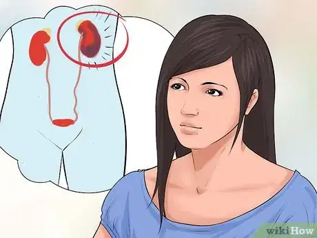 Image titled Treat Hypertension Step 20