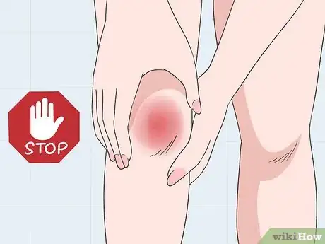 Image titled Avoid Patellar Tendonitis Step 5