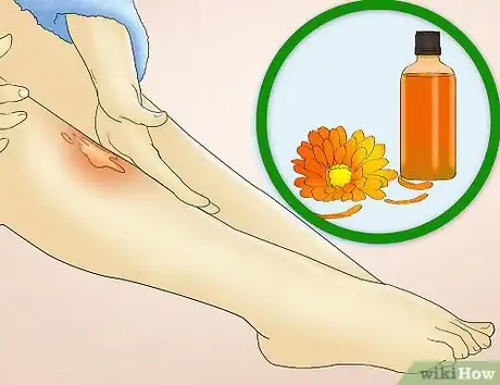 Image titled Reduce Redness After Waxing Step 13
