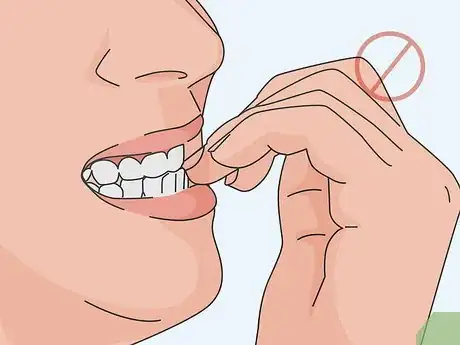 Image titled Deal with the Pain from a Chipped Tooth Step 13