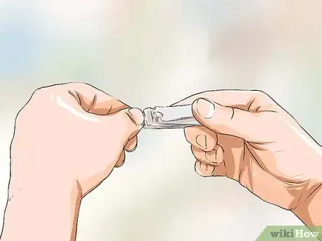 Image titled Reduce Eczema Itching Step 8