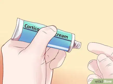 Image titled Spot the Symptoms of Hemorrhoids Step 12