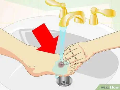 Image titled Care for Superficial Wounds Step 13