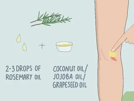 Image titled Heal Skin Naturally Step 4