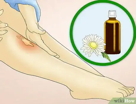 Image titled Reduce Redness After Waxing Step 11