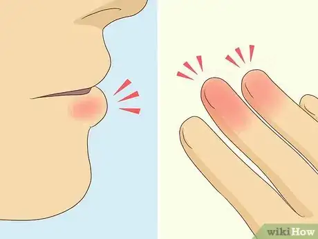 Image titled Treat Hypocalcemia Step 11