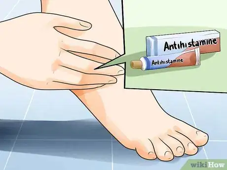 Image titled Know When to Take Antihistamines Step 15